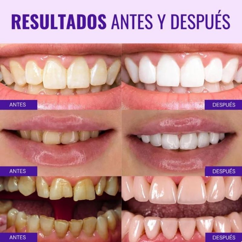 PASTA DENTAL BLANQUEADORA OBSESSIVE®