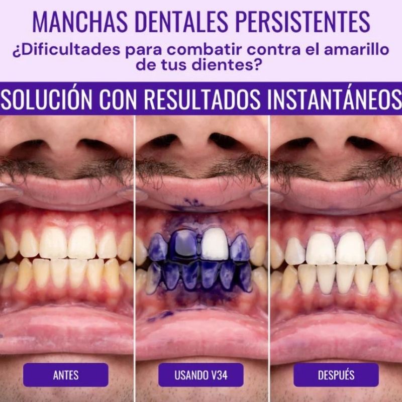 PASTA DENTAL BLANQUEADORA OBSESSIVE®